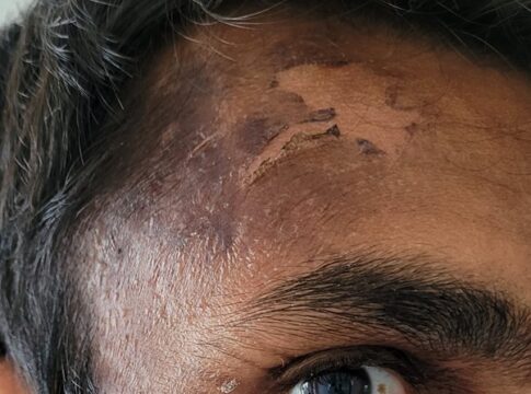 police officer racially attacked