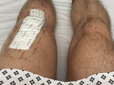 Knee replacement. Photo: LNWH